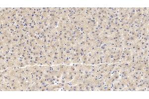 Detection of IL18R1 in Human Liver Tissue using Monoclonal Antibody to Interleukin 18 Receptor 1 (IL18R1)