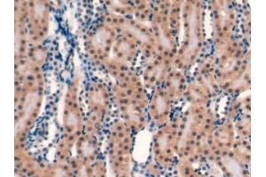 Detection of CD40L in Rat Kidney Tissue using Monoclonal Antibody to Cluster Of Differentiation 40 Ligand (CD40L)