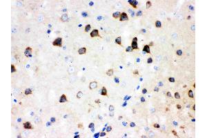 IHC analysis of SSH3BP1 using anti-SSH3BP1 antibody .