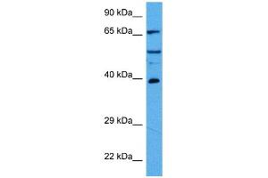 Host:  Rabbit  Target Name:  HDAC2  Sample Tissue:  Mouse Pancreas  Antibody Dilution:  1ug/ml (HDAC2 anticorps  (C-Term))