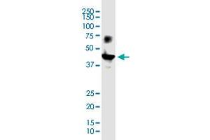 VSTM1 monoclonal antibody (M03), clone 2E12.