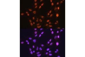 Immunofluorescence analysis of C6 cells using CTCF antibody (ABIN7266164).