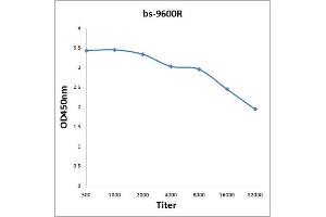 Antigen: 2 µg/100 µL  Primary: Antiserum, 1:500, 1:1000, 1:2000, 1:4000, 1:8000, 1:16000, 1:32000;  Secondary: HRP conjugated Rabbit Anti-Goat IgG at 1: 5000;  TMB staining Read the data in Microplate Reader by 450nm.
