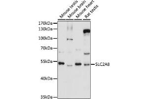 Western blot analysis of extracts of various cell lines, using SLC2 antibody (ABIN7270412) at 1:1000 dilution.