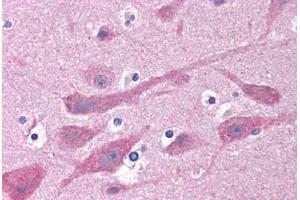 Human Brain, Cortex: Formalin-Fixed, Paraffin-Embedded (FFPE)