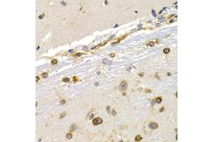 Immunohistochemistry of paraffin-embedded rat brain using EEF1D antibody (ABIN3023318, ABIN3023319, ABIN3023320 and ABIN6219589) at dilution of 1:200 (40x lens). (EEF1D anticorps  (AA 1-160))