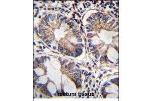 ME2 Antibody (C-term) (ABIN656541 and ABIN2845805) immunohistochemistry analysis in formalin fixed and paraffin embedded human rectum tissue followed by peroxidase conjugation of the secondary antibody and DAB staining. (NAD-ME anticorps  (C-Term))