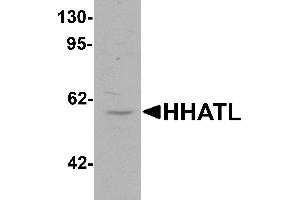 Western blot analysis of HHATL in 3T3 cell lysate with HHATL antibody at 1 µg/mL. (HHATL anticorps  (N-Term))