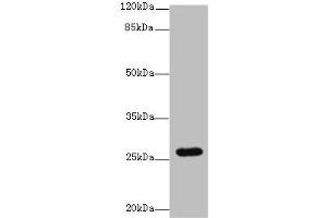 Western blot All lanes: TMEM217 antibody at 10 μg/mL + Jurkat whole cell lysate Secondary Goat polyclonal to rabbit IgG at 1/10000 dilution Predicted band size: 27, 25 kDa Observed band size: 27 kDa (TMEM217 anticorps  (AA 150-211))