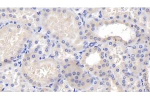 Detection of CALR in Human Kidney Tissue using Polyclonal Antibody to Calreticulin (CALR) (Calreticulin anticorps  (AA 18-193))