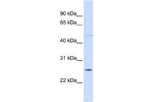 WB Suggested Anti-RNF170 Antibody Titration:  0. (RNF170 anticorps  (C-Term))