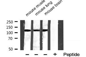 Western blot analysis of extracts of various smaple,using Phospho-HDAC5 (Ser259) Antibody.
