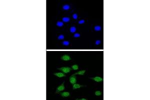 Confocal immunofluorescent analysis of AIRE Antibody (Center) with 293 cell followed by Alexa Fluor® 488-conjugated goat anti-rabbit lgG (green).