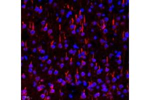 Immunofluorescent analysis of paraformaldehyde-fixed rat brain using TRIM46 (ABIN7076020) at dilution of 1: 3200 (TRIM46 anticorps)