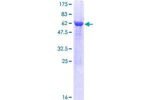 Image no. 1 for Prostaglandin Reductase 2 (PTGR2) (AA 1-351) protein (GST tag) (ABIN1316756)