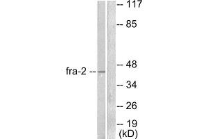 Western blot analysis of extracts from LOVO cells, using Fra-2 antibody (ABIN5976401). (FOSL2 anticorps  (C-Term))