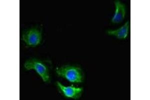 Immunofluorescent analysis of A549 cells using ABIN7172144 at dilution of 1:100 and Alexa Fluor 488-congugated AffiniPure Goat Anti-Rabbit IgG(H+L) (THADA anticorps  (AA 432-651))