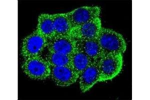 Confocal immunofluorescent analysis of Hamartin antibody with HeLa cells followed by Alexa Fluor 488-conjugated goat anti-rabbit lgG (green).