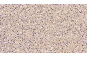 Detection of PIIINP in Porcine Liver Tissue using Monoclonal Antibody to Procollagen III N-Terminal Propeptide (PIIINP)