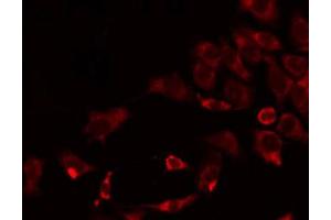 ABIN6266912 staining HeLa by IF/ICC.