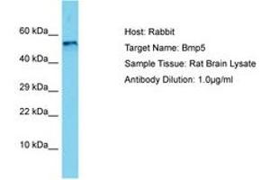 Image no. 1 for anti-Bone Morphogenetic Protein 5 (BMP5) (AA 327-376) antibody (ABIN6750503) (BMP5 anticorps  (AA 327-376))