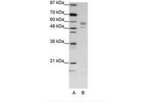 Image no. 1 for anti-Serine--tRNA Ligase, Cytoplasmic-Like (C-Term) antibody (ABIN202697) (Serine--tRNA Ligase, Cytoplasmic-Like (C-Term) anticorps)