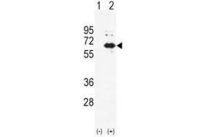 Western blot analysis of Alkaline Phosphatase antibody and 293 cell lysate (2 ug/lane) either nontransfected (Lane 1) or transiently transfected (2) with the ALPL gene. (ALPL anticorps  (AA 217-246))