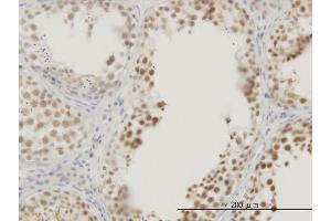 Immunoperoxidase of monoclonal antibody to RASSF8 on formalin-fixed paraffin-embedded human testis.