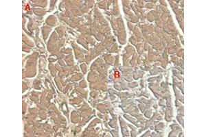 Immunohistochemical staining of human tissue using anti-ST2 (human), mAb (ST33868)  at 1:100 dilution.
