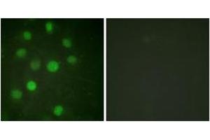 Immunofluorescence analysis of HuvEc cells, using Histone H1 (Ab-17) Antibody. (Histone H1 anticorps  (AA 1-50))