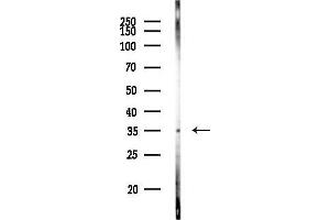 Western blot analysis of lysates from K562 cells(UV 30 min treatment), using MAPRE1 Antibody at 1/1000 dilution.