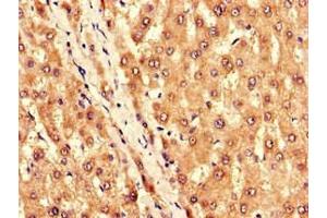 Immunohistochemistry of paraffin-embedded human liver tissue using ABIN7145021 at dilution of 1:100 (KCNJ11 anticorps  (AA 172-390))