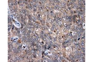 Immunohistochemical staining of paraffin-embedded Kidney tissue using anti-APP mouse monoclonal antibody. (APP anticorps)