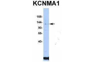 Host:  Rabbit  Target Name:  KCNMA1  Sample Type:  Jurkat  Antibody Dilution:  1. (KCNMA1 anticorps  (C-Term))