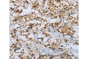 Immunohistochemistry of Human brain  using CMTM8 Polyclonal Antibody at dilution of 1:40 (CMTM8 anticorps)