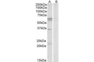 Western Blotting (WB) image for anti-Solute Carrier Family 7 (Cationic Amino Acid Transporter, Y+ System), Member 5 (SLC7A5) (Internal Region) antibody (ABIN2464279) (SLC7A5 anticorps  (Internal Region))