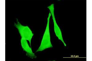 anti-Frizzled Family Receptor 3 (FZD3) (AA 55-157) antibody