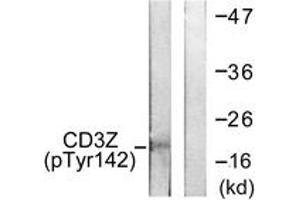 Western blot analysis of extracts from Jurkat cells treated with UV 15', using CD3 zeta (Phospho-Tyr142) Antibody. (CD247 anticorps  (pTyr142))