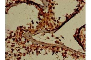 Immunohistochemistry of paraffin-embedded human testis tissue using ABIN7154194 at dilution of 1:100