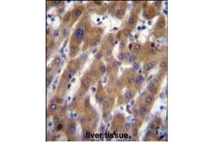UB Antibody (N-term) (ABIN656700 and ABIN2845933) immunohistochemistry analysis in formalin fixed and paraffin embedded human liver tissue followed by peroxidase conjugation of the secondary antibody and DAB staining. (UBAP2 anticorps  (N-Term))