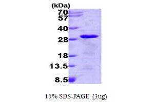 SDS-PAGE (SDS) image for Tumor Protein, Translationally-Controlled 1 (TPT1) (AA 1-172) protein (His tag) (ABIN666938) (TPT1 Protein (AA 1-172) (His tag))