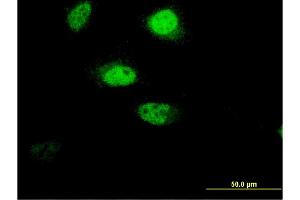 Immunofluorescence of monoclonal antibody to RNF207 on HeLa cell. (RNF207 anticorps  (AA 135-244))
