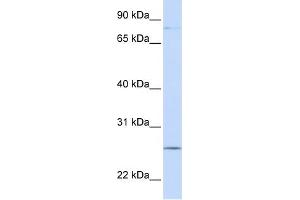 WB Suggested Anti-PCDHGC3 Antibody Titration:  0. (Protocadherin gamma Subfamily C, 3 (PCDHGC3) (N-Term) anticorps)