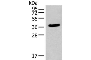 Western blot analysis of HEPG2 cell lysate using ACBD4 Polyclonal Antibody at dilution of 1:400 (ACBD4 anticorps)