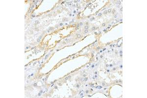 Immunohistochemistry of paraffin-embedded human kidney using Prostatic Acid Phosphatase (ACPP) Rabbit pAb (ABIN3022671, ABIN3022672, ABIN3022673 and ABIN6219082) at dilution of 1:50 (40x lens). (ACPP anticorps  (AA 40-300))