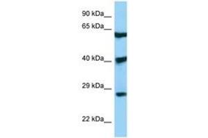 Image no. 1 for anti-DKK3 (AA 51-100) antibody (ABIN6748413) (DKK3 anticorps  (AA 51-100))