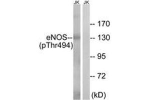 Western blot analysis of extracts from Jurkat cells, using eNOS (Phospho-Thr494) Antibody. (ENOS anticorps  (pThr495))