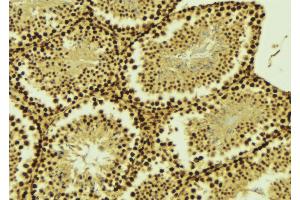 ABIN6268696 at 1/100 staining Mouse testis tissue by IHC-P. (EZH2 anticorps  (Internal Region))