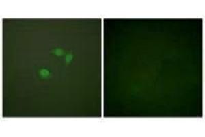 Immunofluorescence analysis of NIH/3T3 cells, using Sumo1 antibody.