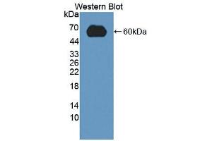 Western blot analysis of the recombinant protein. (LDLR anticorps  (AA 263-509))